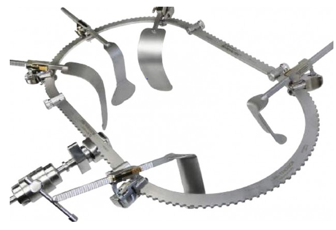 Bookwalter Retractor