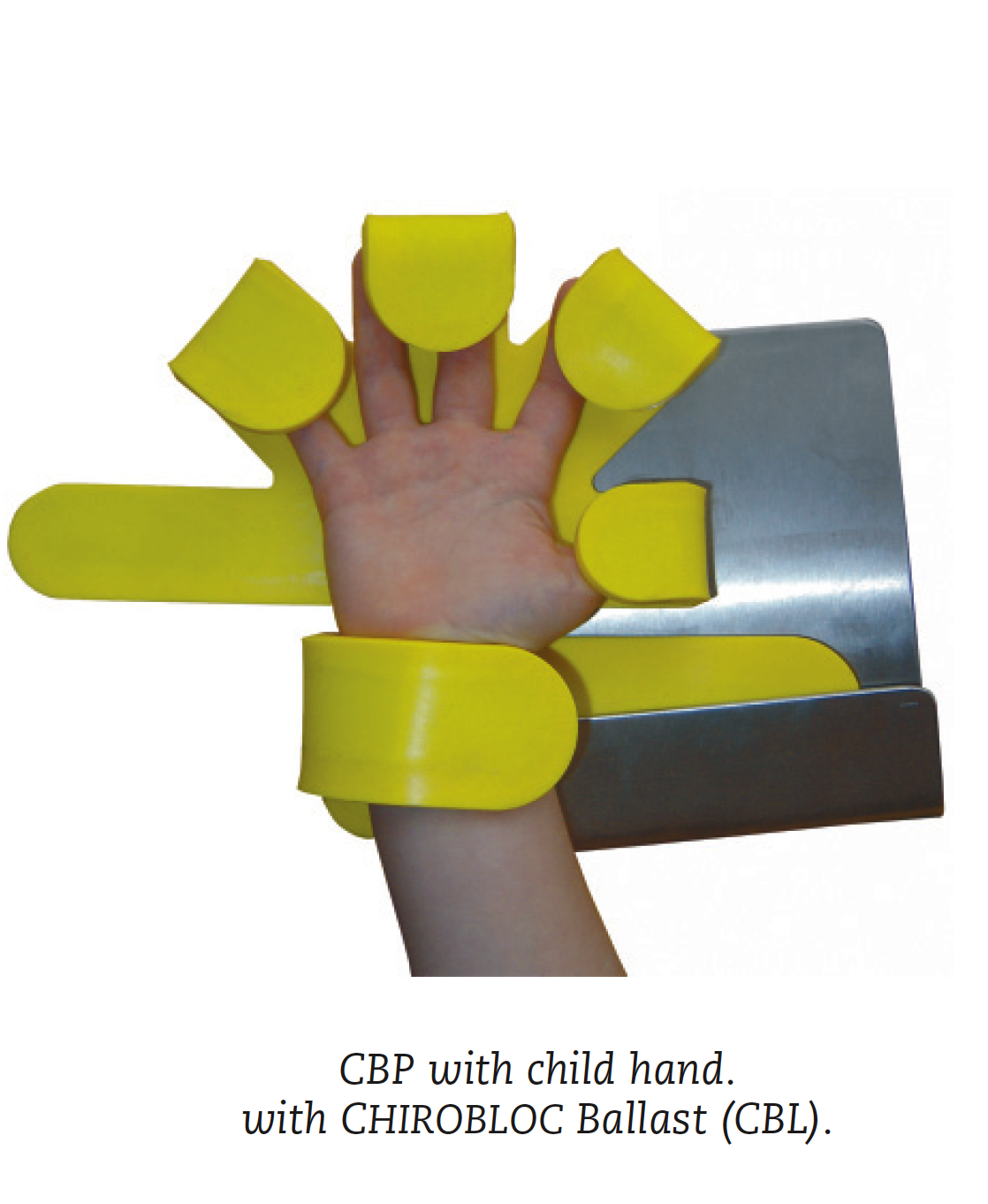 Child with Chirobloc hand immobiliser